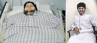 12 years.. lost 550 kg